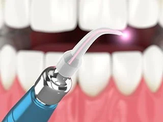 Diode laser coming from dental device