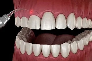 Cosmetic gum coloring