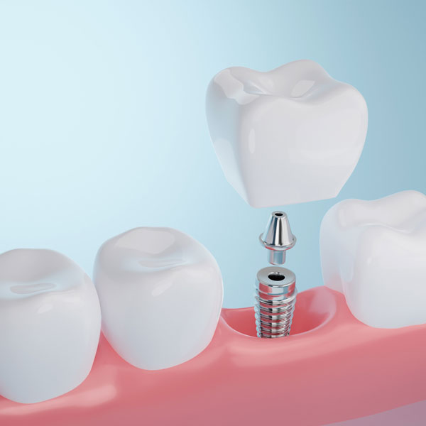 DeMarco-Dental-1402568717