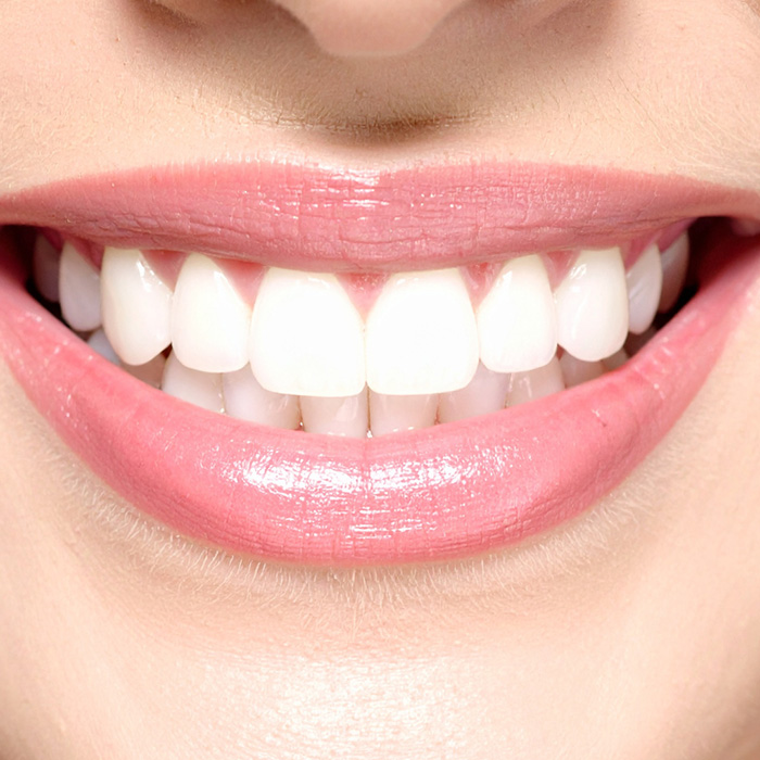 demarco-dental-implants